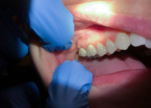 Best Emergency Gum Pain Relief  in Maynardville, TN